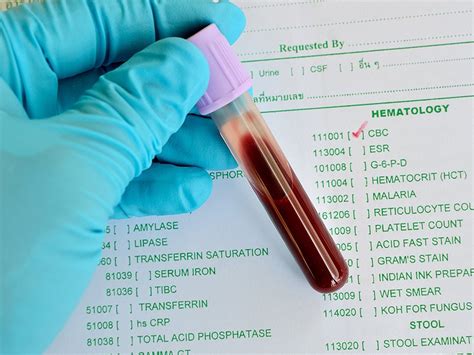 If multiple tests are ordered, please submit a separate tube for this test. . Blood test quest